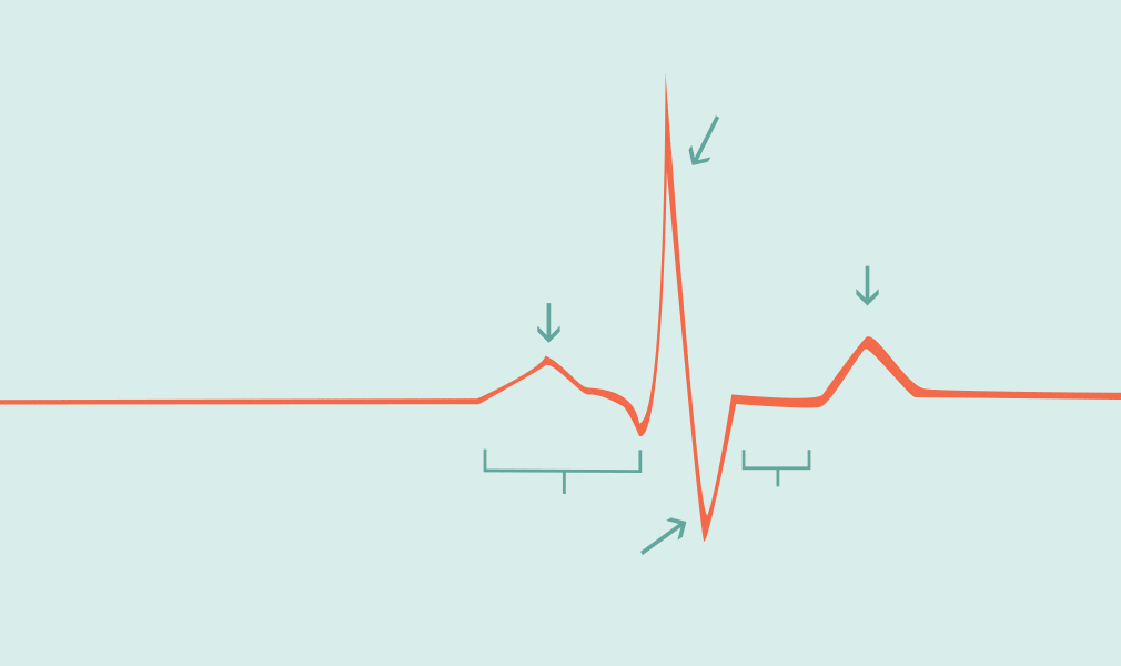 graph showing the questions about alcohol detox