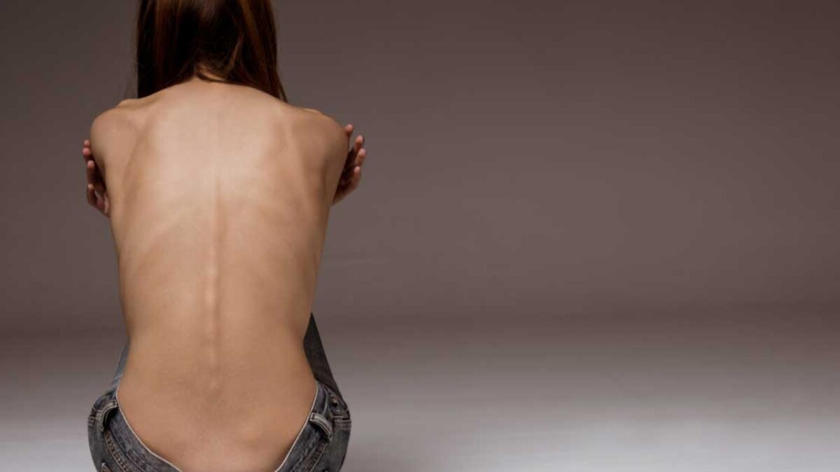 anorexic boned nude  