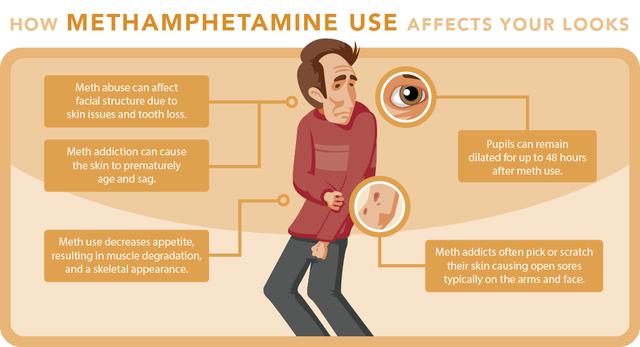How Methamphetamine Affects Your Looks